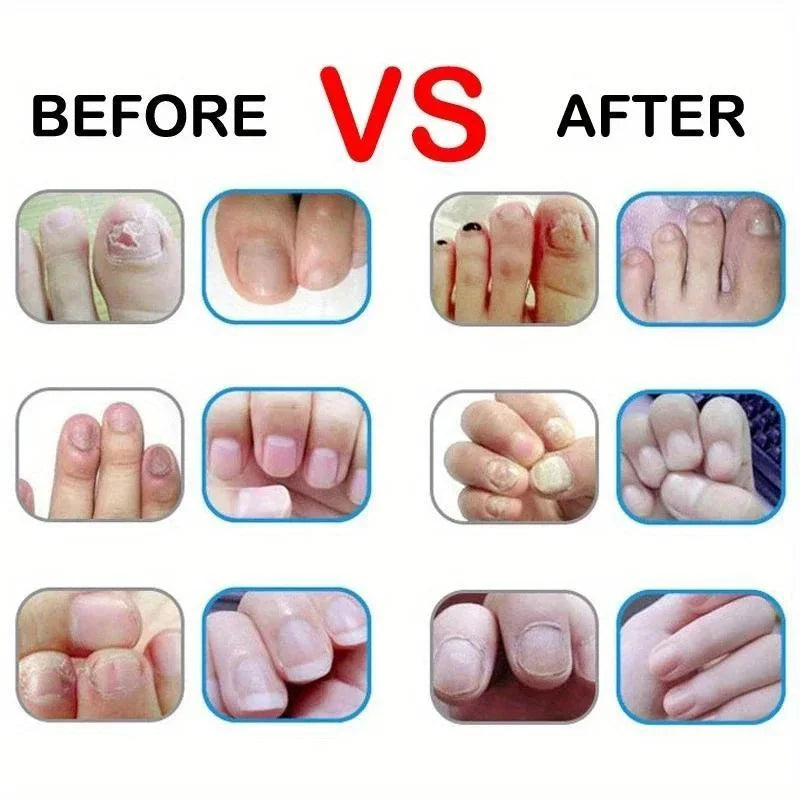 Nail Nutrition Oil Pen Nail Treatment Cuticle Revitalizer Oil Prevent Agnail Nail Polish Nourish Skin